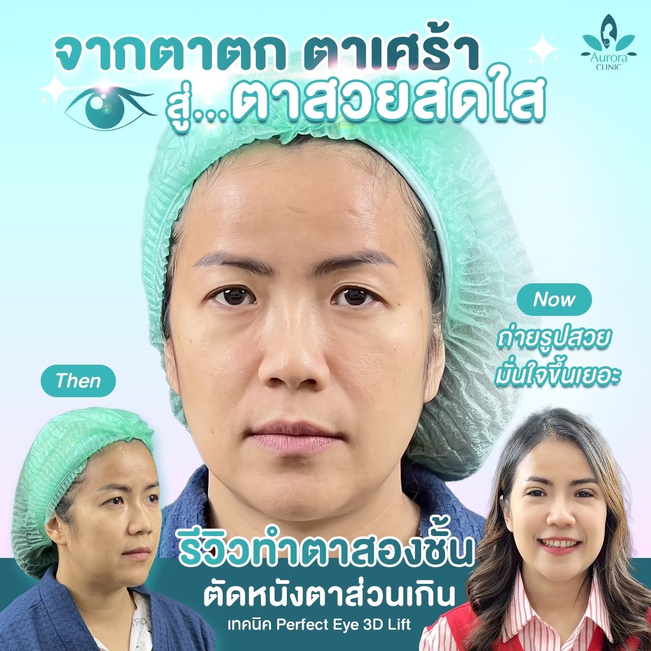 การดูแลในระยะยาว: การคงความสวยงามอย่างยั่งยืน – 